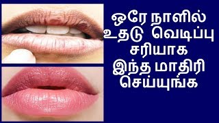 பனியால் வறண்ட உதடுகள் ரோஜா இதழ் போன்று மிருதுவாக.. இந்த ஒரு பொருள் யூஸ் பண்ணுங்க!!