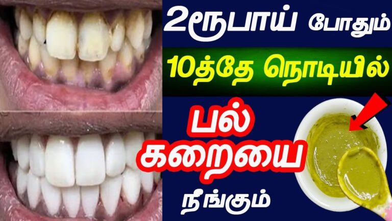 பற்களில் உள்ள எல்லோ கறைகள் அகல.. இந்த பழத்தின் தோலை கொண்டு பல் துலக்குங்கள்!!