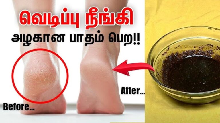 தயிரை இப்படி பயன்படுத்தினால்.. பனி காலத்திலும் பாதங்கள் பஞ்சு போன்று மிருதுவாக இருக்கும்!!