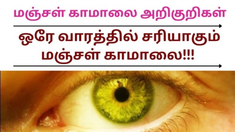 இந்த ஒரு இலையின் மகிமை தெரிந்தால்.. மூக்கு மேல் விரல் வைப்பீங்க!! மஞ்சள் காமாலை நோய்க்கு பெஸ்ட் மருந்து இது மட்டுமே!!