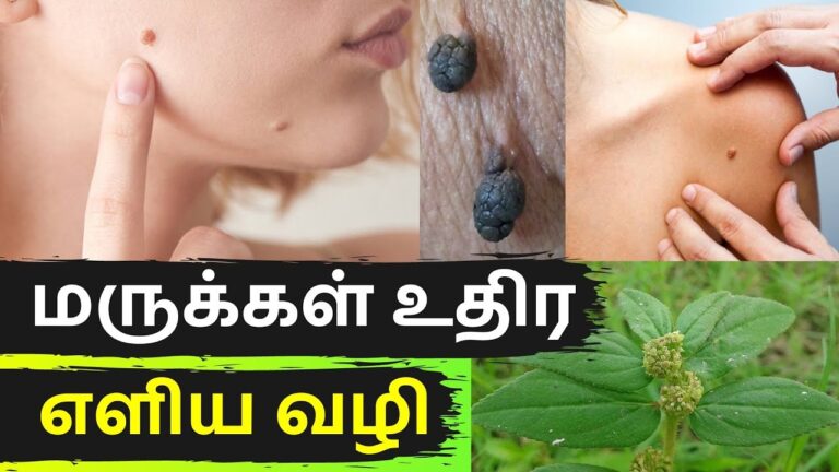 தோலில் ஒட்டிக்கிடக்கும் மருக்களை கொட்டச் செய்யும் சின்ன வெங்காயம்!! கூட இந்த ஒரு பொருளையும் சேர்த்துக்கோங்க!!