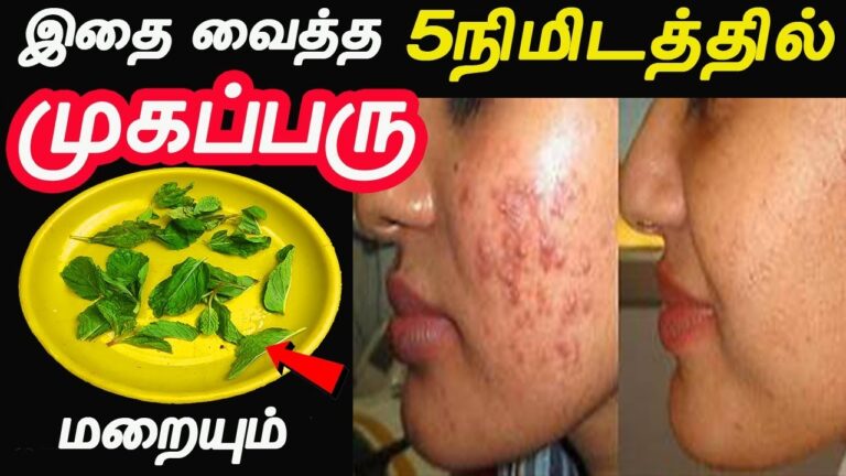 முகப்பரு மற்றும் சரும வறட்சி நீங்க.. இந்த கசப்பு இலையை கொதிக்க வைத்து குடிங்க!!