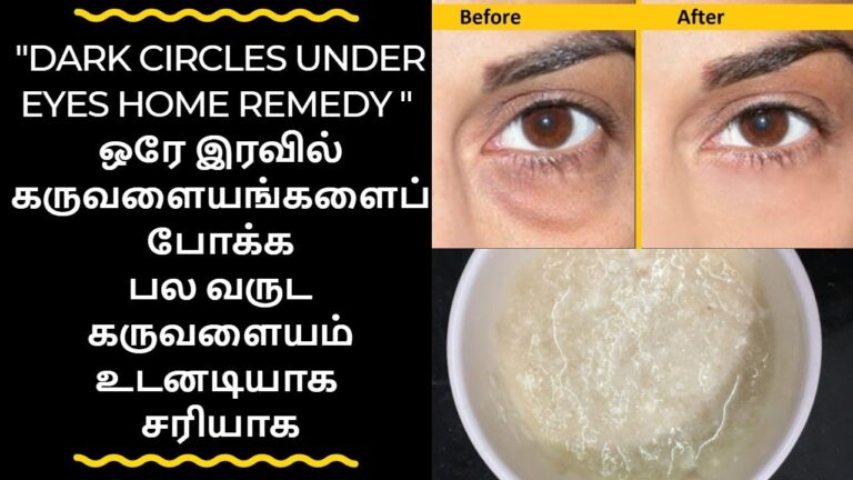 கண் கருவளையத்தை மறைய வைக்கும் நேச்சுரல் க்ரீம்!! ஒருமுறை பயன்படுத்தினாலே கருப்பு நீங்கும்!!
