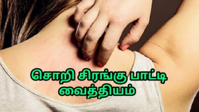 சொறி சிரங்கு புண்களை குணமாக்கும் அதிசய இலை!! பலன் கிடைக்க.. ஜஸ்ட் ஒன் டைம் ட்ரை பண்ணுங்க போதும்!!