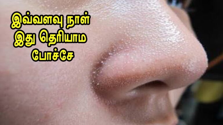 மூக்கின் மேல் உள்ள பிளாக் மற்றும் வொயிட்ஹெட்ஸ் நீங்க.. இந்த பேஸ்ட்டை பயன்படுத்துங்கள்!!