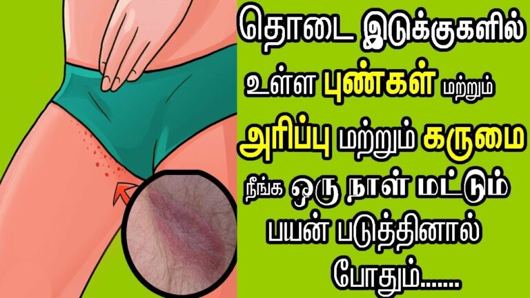 தொடை இரண்டும் உரசி உரசியே புண்ணாகிடுச்சா? பீல் பண்ணாதிங்க.. இந்த எண்ணெயை அங்கு தடவி சரி பண்ணுங்க!!