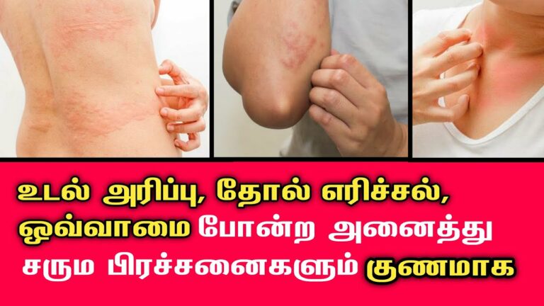 தோல் அரிப்பு? இந்த இரண்டு இலைகளை அரைத்து பூசி குளிங்க.. இனி பிப்பு ஏற்படாது!!