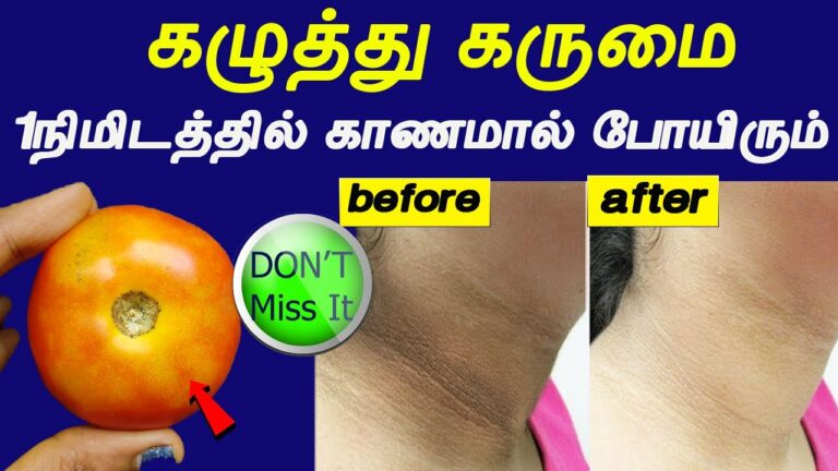 ஒரு தக்காளி இருந்தால்.. கழுத்தை சுற்றியுள்ள கருமை ஒரே நாளில் காணாமல் போய்விடும்!!