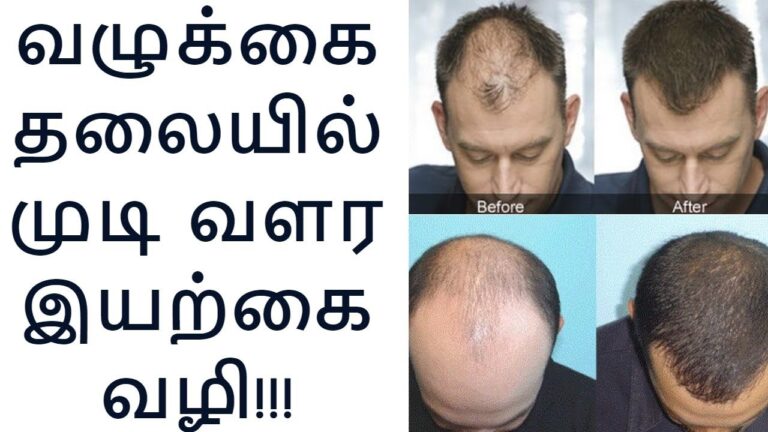 ஒரே ஒரு தக்காளியை இப்படி யூஸ் பண்ணினால்.. வழுக்கை தலையில் பேபி ஹேர் முளைக்கும்!!