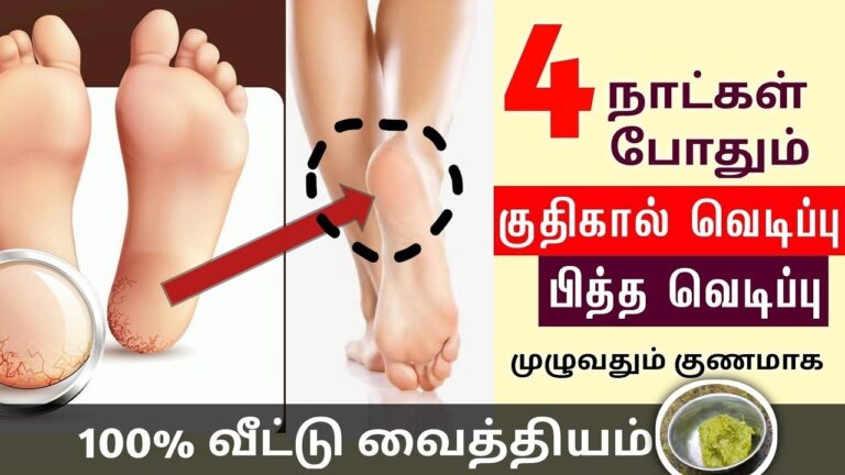 இரவோடு இரவாக குதிகால் வெடிப்பு மறைந்து போக.. ஒரு ஸ்பூன் தேங்காய் எண்ணையுடன் இந்த பொருளை சேர்த்து வெடிப்பில் பூசுங்கள்!!