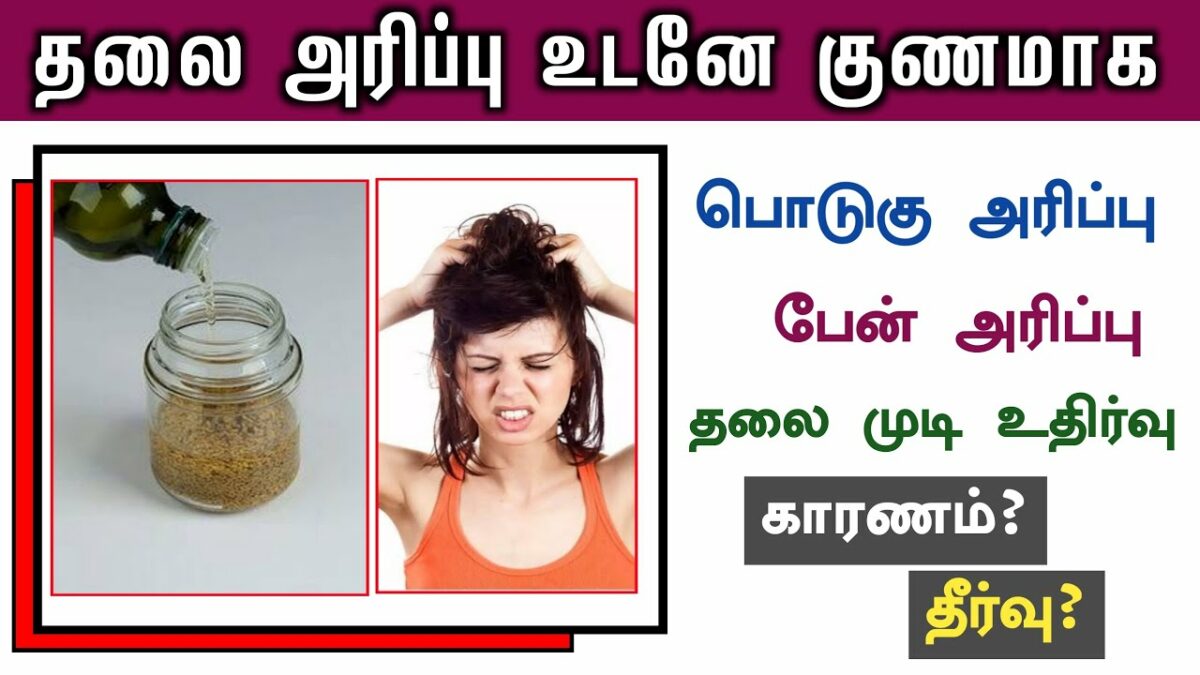 10 day solution.. Just apply this with coconut oil for hair loss dandruff problem!!