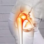 Is hip pain driving you down!! Is there joint wear and tear..? This is enough for no more hip pain!!