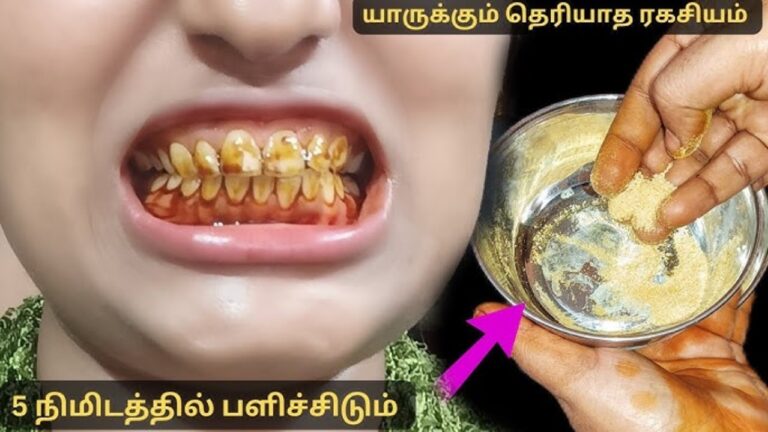 மஞ்சள் நிறமே மஞ்சள் நிறமே.. பற்களில் படிந்த கறைகளை நீக்க இந்த பொருளை கொண்டு பிரஸ் பண்ணுங்க!!