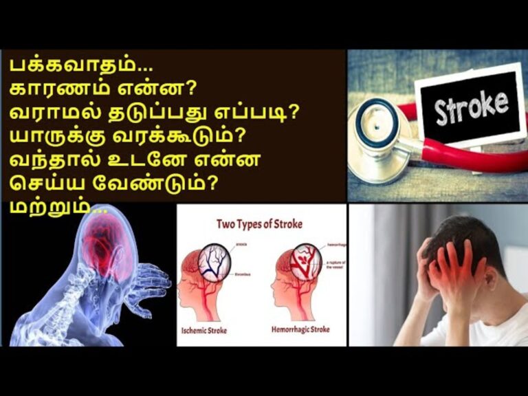 ஜாக்கிரதை! இந்த பிரச்சனை இருப்பவர்களுக்கு பக்கவதாம் வர 99% வாய்ப்பு இருக்கு!!