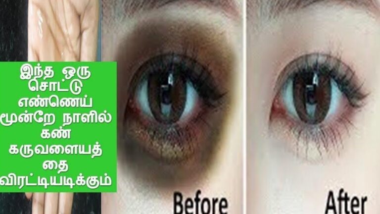 டார்க் சர்க்குல்ஸ் மேஜிக் போட்டது போல் மறைய வேண்டுமா? இதற்கு பெஸ்ட் ரோஸ் வாட்டர் தான்!!