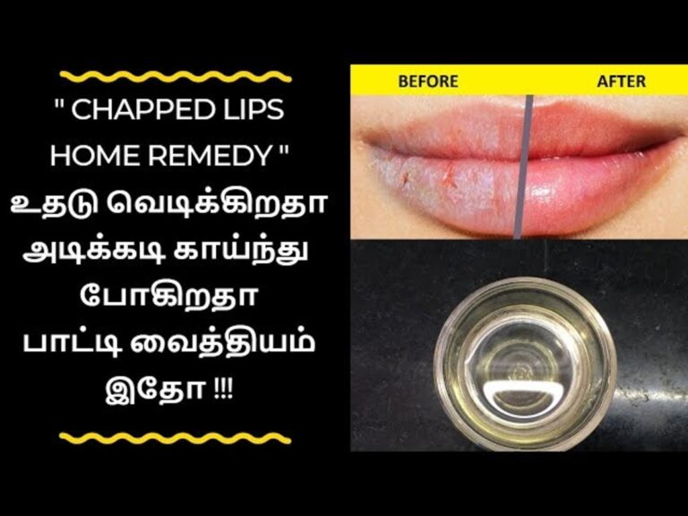 உதட்டு தோல் காய்ந்து எரிச்சலா இருக்கா? உதடு சாஃப்ட்டாக.. தேங்காய் எண்ணையுடன் இந்த ஒரு பொருளை சேர்த்து பூசுங்கள்!!