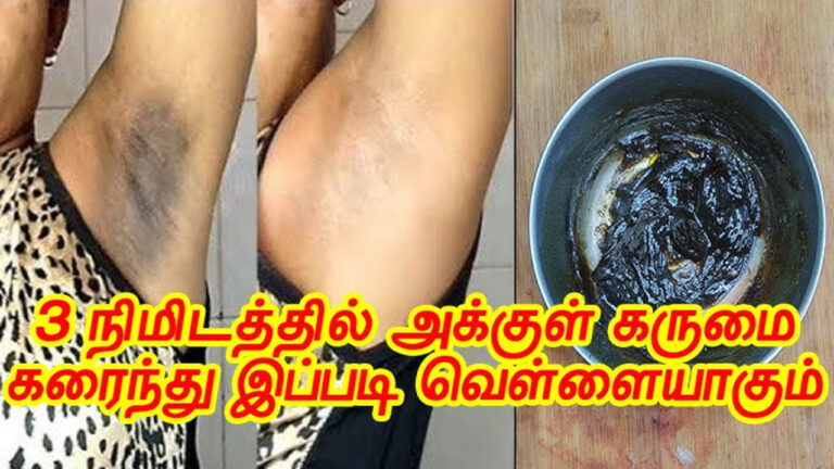 கழுத்து மற்றும் அக்குள் பகுதி அடர் கருமையா இருக்கா? வெள்ளையாக இந்த க்ரீம் யூஸ் பண்ணுங்க!!