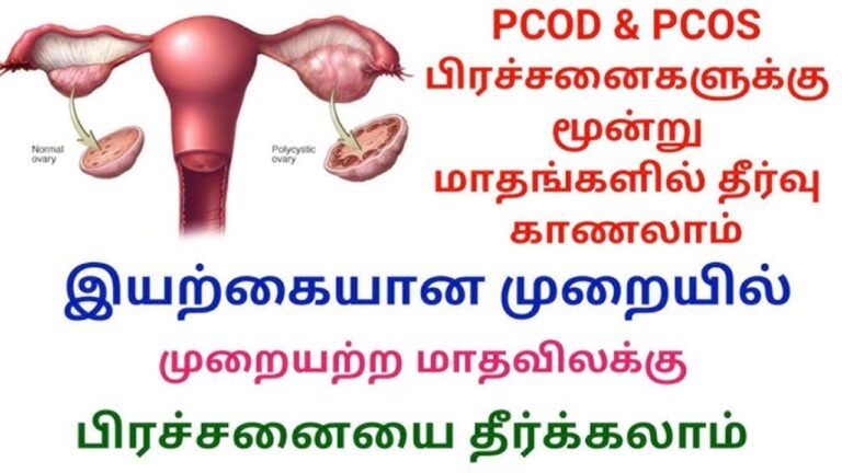 என்ன சாப்பிட்டால் PCOS குணமாகும்? பெண்கள் அவசியம் தெரிந்து கொள்ளுங்கள்!!