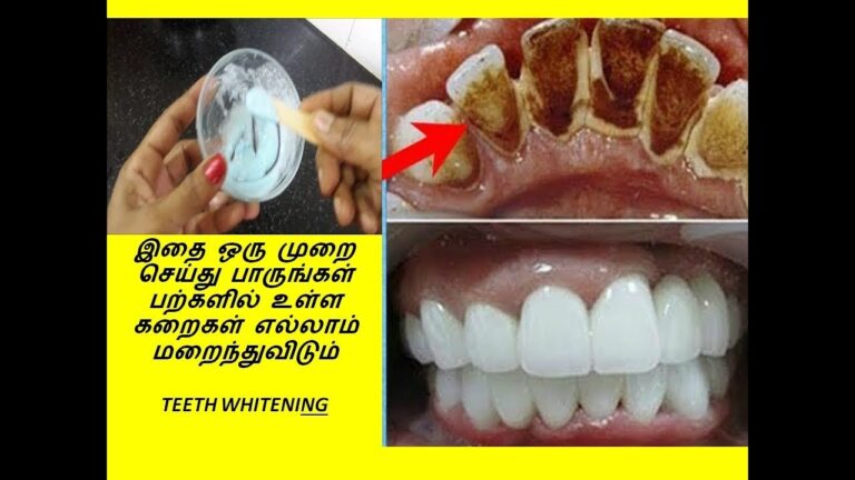 மஞ்சள் கறை படிந்த பற்கள் வெள்ளையாக.. டூத் பேஸ்ட்டில் இதை சேர்த்து பல் துலக்குங்கள்!!