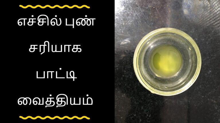 வாய் ஓரத்தில் உள்ள எச்சில் புண்களை குணமாக்கும் பெஸ்ட் ஹோம் ரெமிடி இதோ!! இப்போவே ட்ரை பண்ணி பாருங்க!!