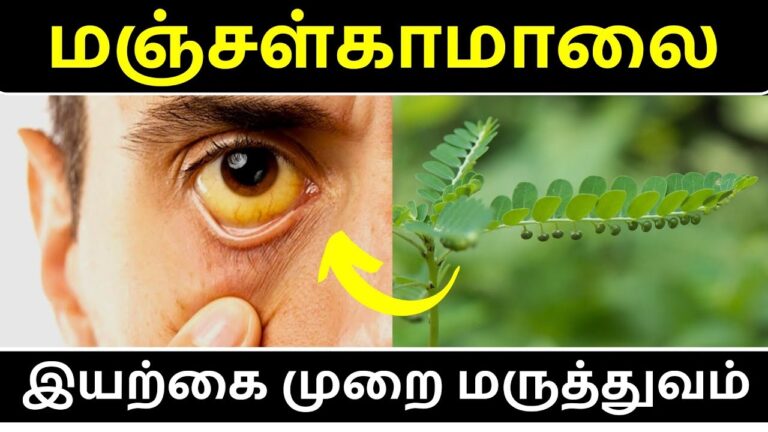 Jaundice: ஒரே நாளில் கொடிய மஞ்சள் காமாலையை குணப்படுத்தும்.. இந்த வீட்டு வைத்தியம் தெரியுமா?