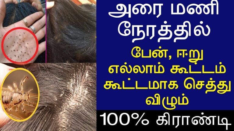 தலையில் பேன் ஈறு கூட்டம் கூட்டமா அப்பிக்கிட்டு இருக்கா? இதை ஒழித்துக்கட்ட உடனே இந்த எண்ணெயை தேய்த்து தலைக்கு குளிங்க!!