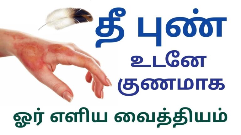 நெருப்பு பட்டு புண்ணாகிடுச்சா? தரையில் படர்ந்து கிடக்கும் இந்த செடியை அரைத்து பூசினால் புண்கள் ஆறும்!!