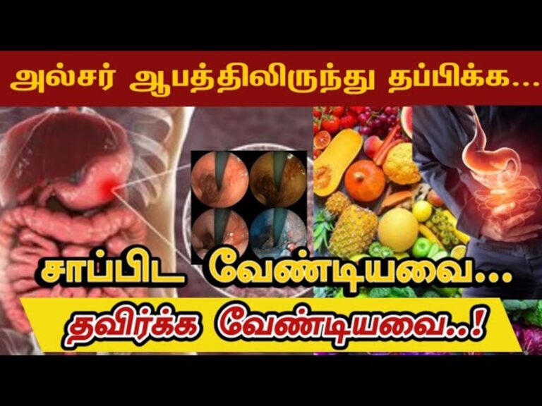 அல்சர் பிரச்சனை உள்ளவர்கள் ஒதுக்க வேண்டிய மற்றும் சாப்பிட வேண்டிய உணவுகள் பட்டியல் இதோ!!