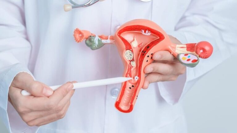PCOD மற்றும் PCOS பிரச்சனை எதனால் ஏற்படுகிறது? இதன் அறிகுறிகள் மற்றும்  இதற்கான தீர்வு!!