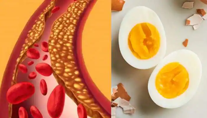 Does eating eggs increase cholesterol!! Doctor's explanation!!