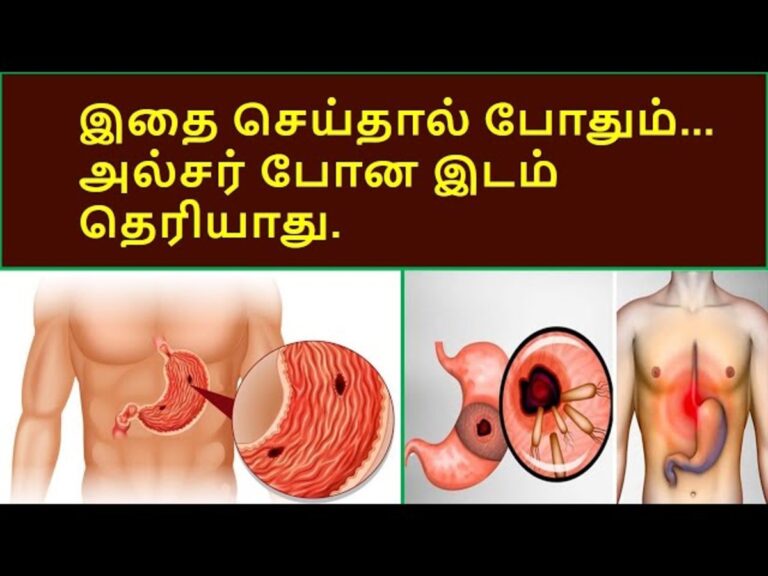 இந்த பொருளை வாயில் வைத்தாலே.. வயிற்றில் உருவான அல்சர் எளிதில் குணமாகிவிடும்!!