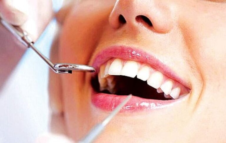 உங்கள் வெள்ளை பற்களின் சொத்தை விழாமல் இருக்க இந்த டிப்ஸை தொடர்ந்து பாலோ பண்ணுங்கள்!!