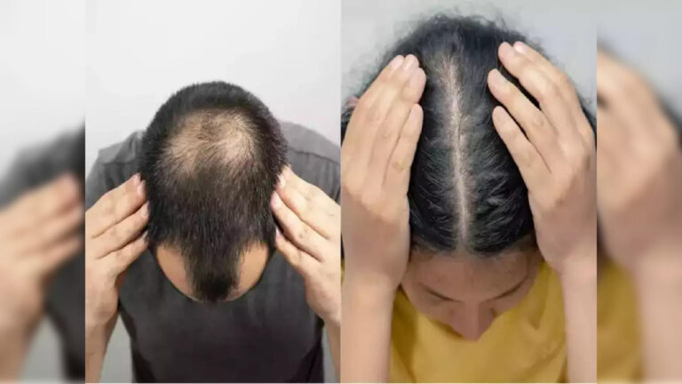 இந்த இரண்டு விரல்கள் 2D:4D இருக்க.. அப்போ உங்களுக்கு சொட்டை விழ 100% சான்ஸ் இருக்கு!!