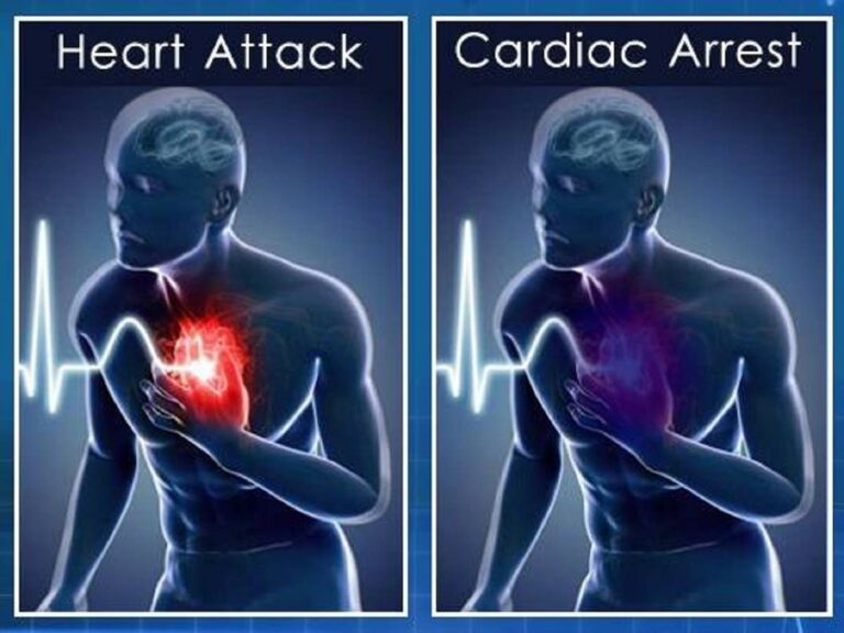 Heart attack Vs Cardiac arrest.. இரண்டிற்கும் உள்ள வித்தியாசம் என்ன? எதனால் இந்த நோய் ஏற்படுகிறது?