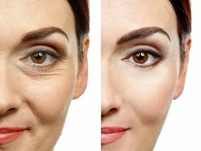 Wrinkles நீங்கி இளமையாக இருக்க.. உளுந்துடன் இந்த நான்கு பொருளை அரைத்து முகத்தில் பூசுங்கள்!!