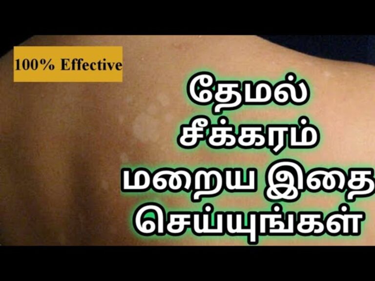 ஒரு பல் பூண்டு போதும்.. ஓவர் நைட்டில் தேமல் மாயமாகிவிடும்!! 100% அனுபவ உண்மை!!