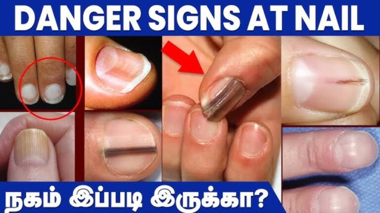 உங்கள் நகம் என்ன கலர்ல இருக்குனு பாருங்க!! இந்த நிறத்தில் இருந்தால் ஆபத்தாம்!!