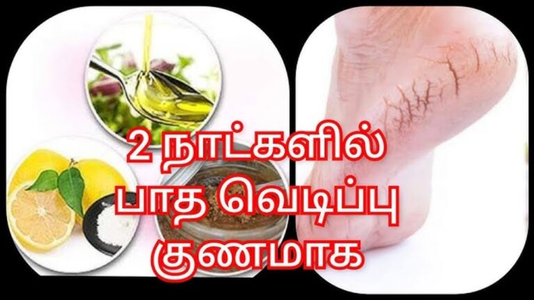 பாத வெடிப்பின் மீது இதை பூசினால்.. வெடிப்புகள் மாயமாய் மறைந்து போகும்!!