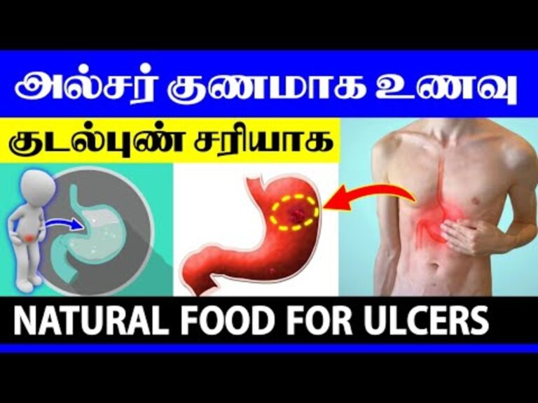பல வருட வயிற்றுப்புண்ணை ஒரு வாரத்தில் குணப்படுத்தும் உணவுகள்!! அல்சர் இருப்பவர்கள் அவசியம் பாலோ பண்ணுங்க!!