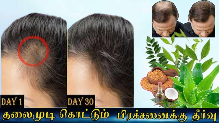 இழந்த முடியை ஒரே வாரத்தில் வளர வைக்கும் ஆயுர்வேத வைத்தியம்!! எல்லோரும் ட்ரை பண்ணுங்க!!