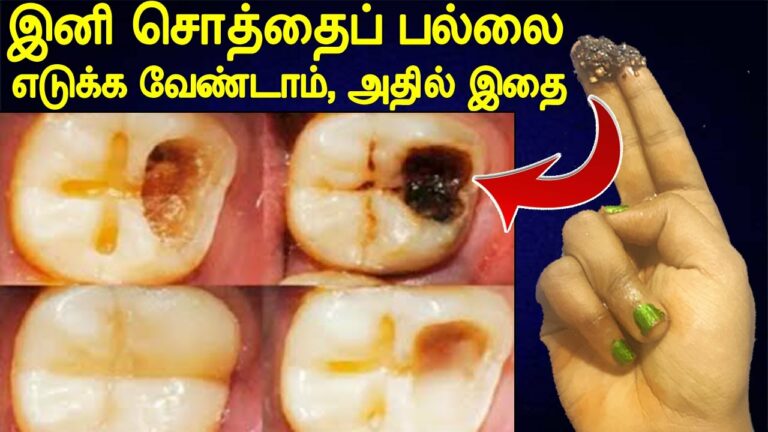 சொத்தைப் பல் குழியில் இந்த இலையை வைத்து அழுத்தினால்.. புழுக்கள் துடித்து வெளியேறிவிடும்!!