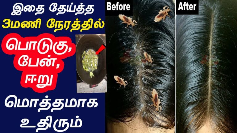 HAIR CARE TIPS: இந்த கீரையை அரைத்து தலைக்கு பூசினால்.. எந்த பிரச்சனை சரியாகும் தெரியுமா?