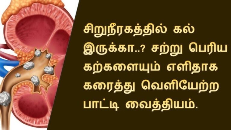 100 சிறுநீரக கற்களை கரைக்கும் அபூர்வ ஜூஸ்!! ஒரு கிளாஸ் குடித்தாலே கிட்னி ஸ்டோனுக்கு மருத்துவ செலவு ஏற்படாது!!
