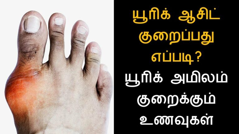 யூரிக் ஆசிட் கப்பு சிப்புனு குறையணுமா? அப்போ இந்த உலர் விதைகளை சாப்பிடுங்கள்!!