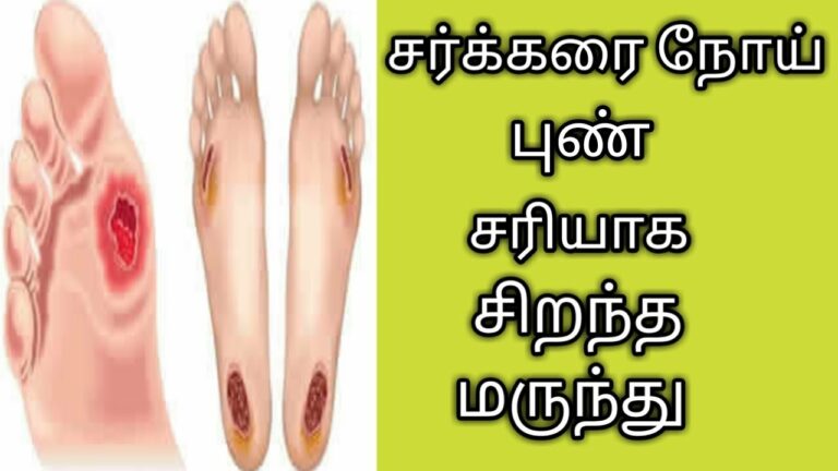 நீண்ட கால சர்க்கரை நோய் புண்களை குணமாக்கும் அதிசய பூ!! மிஸ் பண்ணிடாதீங்க!!