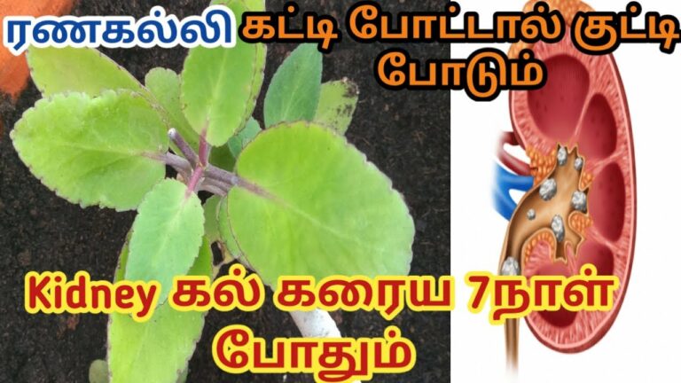 ஒரு வாரத்தில் சிறுநீரக கல் ஐஸ்கட்டி போல் கரைய.. இந்த அதிசய இலையை இப்படி பயன்படுத்துங்கள்!!