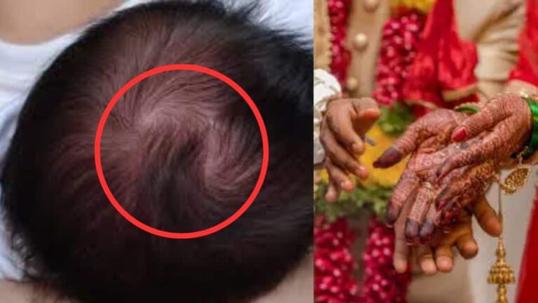 தலையில் இரட்டை சுழி இருந்தால் இரண்டு திருமணமா..?? ஜோதிடம் கூறுவது என்ன..??