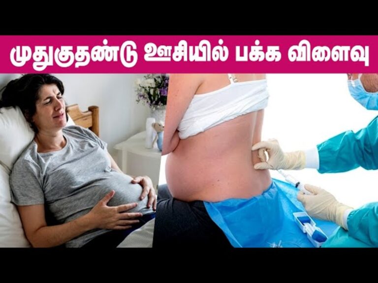 முதுகெலும்பு தண்டில் மயக்க ஊசி போடுவதனால் என்ன மாதிரியான பாதிப்புகள் ஏற்படும் தெரியுமா?