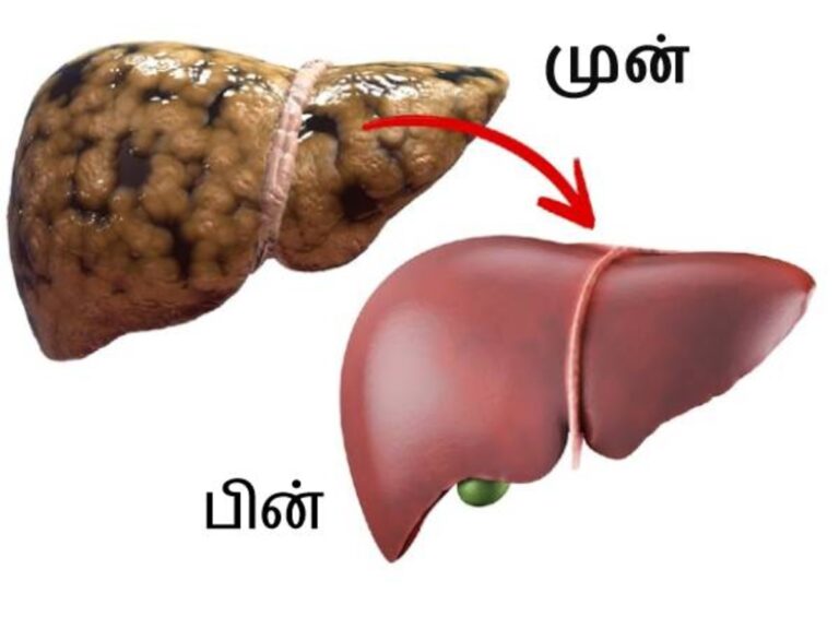 கல்லீரல் உறுப்பில் குவிந்து கிடக்கும் நச்சுக் கழிவுகள் வெளியேற.. இந்த ட்ரிங்க் குடிங்க!!