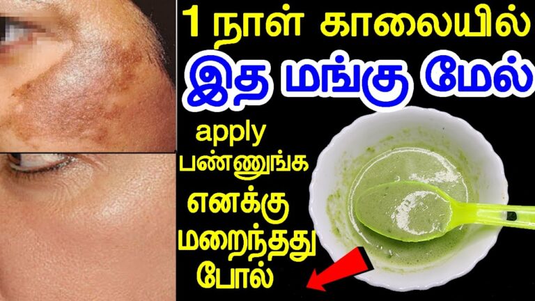 கன்னத்தில் படர்ந்த மங்கு மங்கி போக.. தயிரில் இதை கலந்து தடவி பாருங்கள்!!